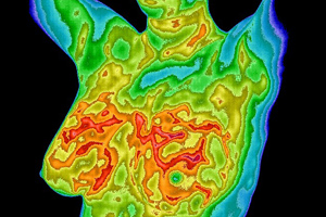 Thermogram