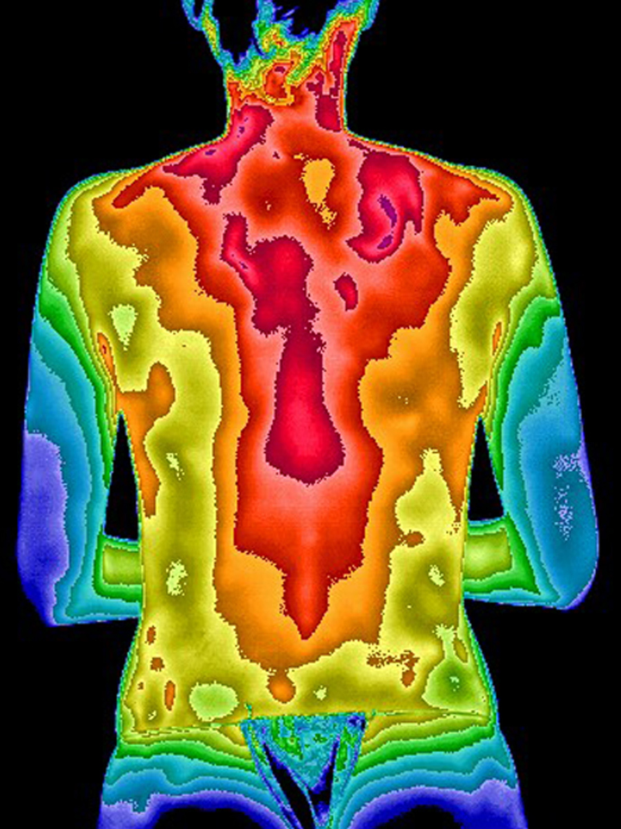 Thermogram of back