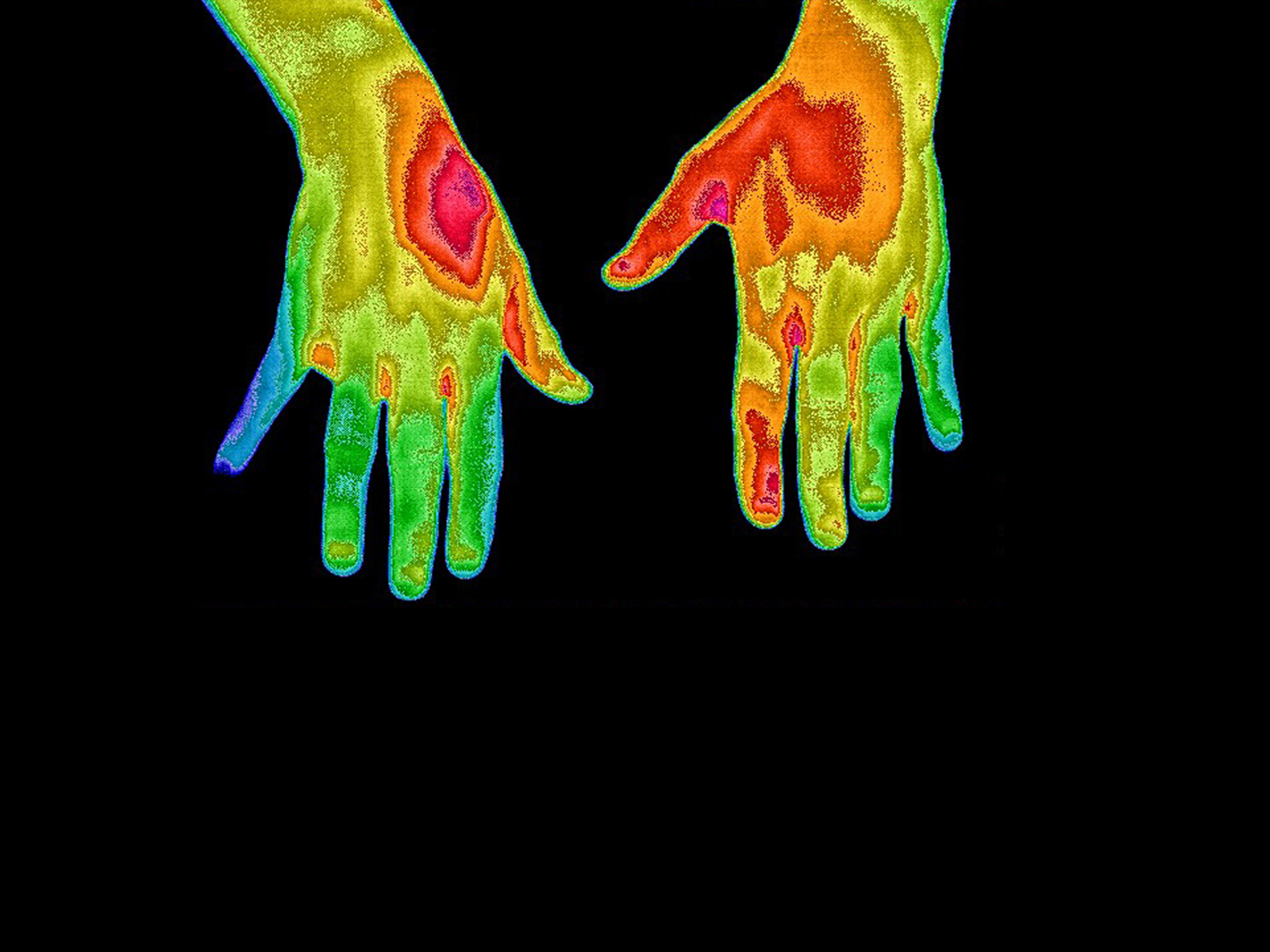 Thermogram of hands