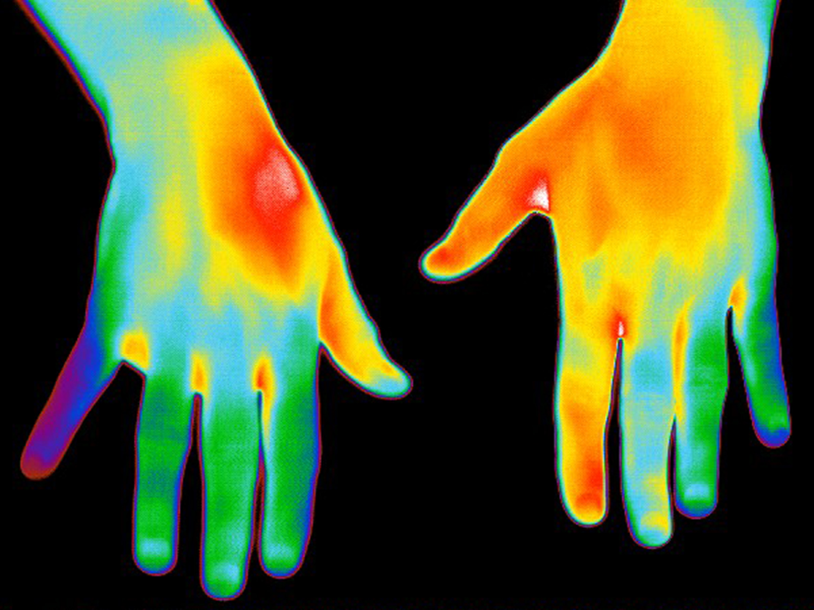 Thermogram of hands two