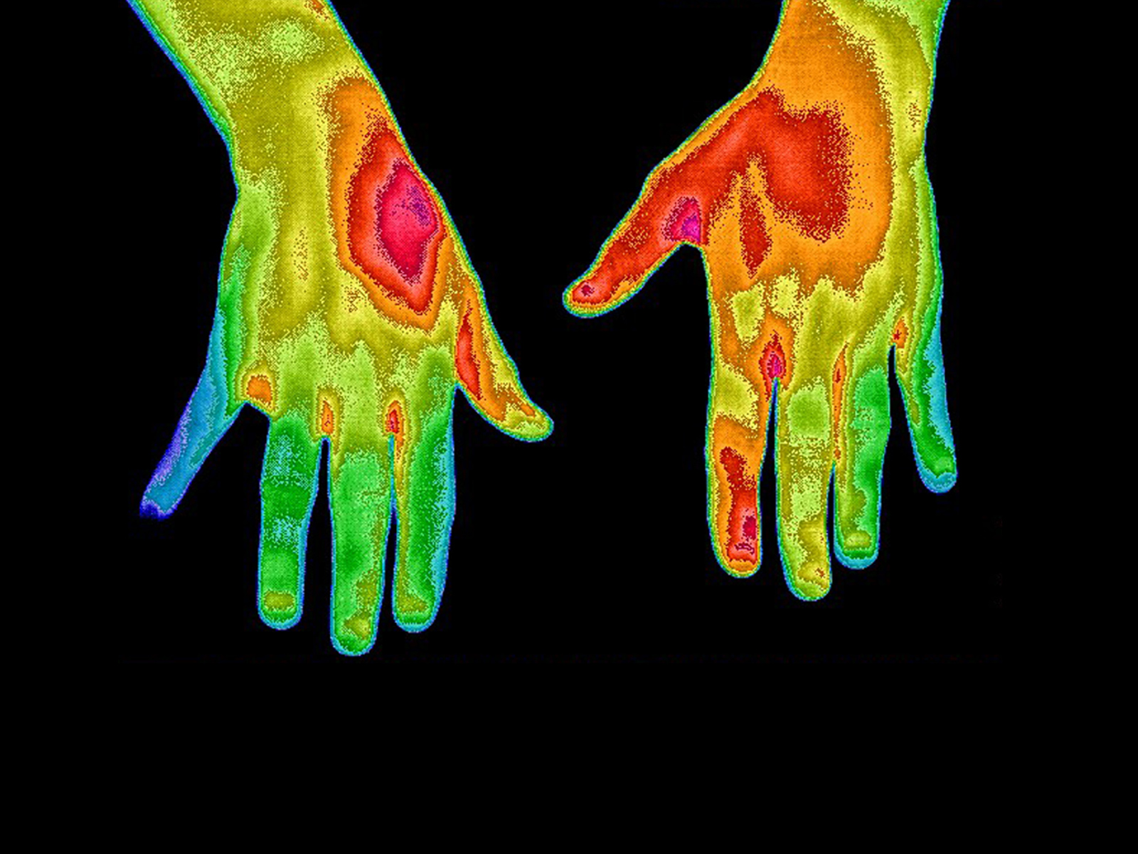 Thermogram of hands