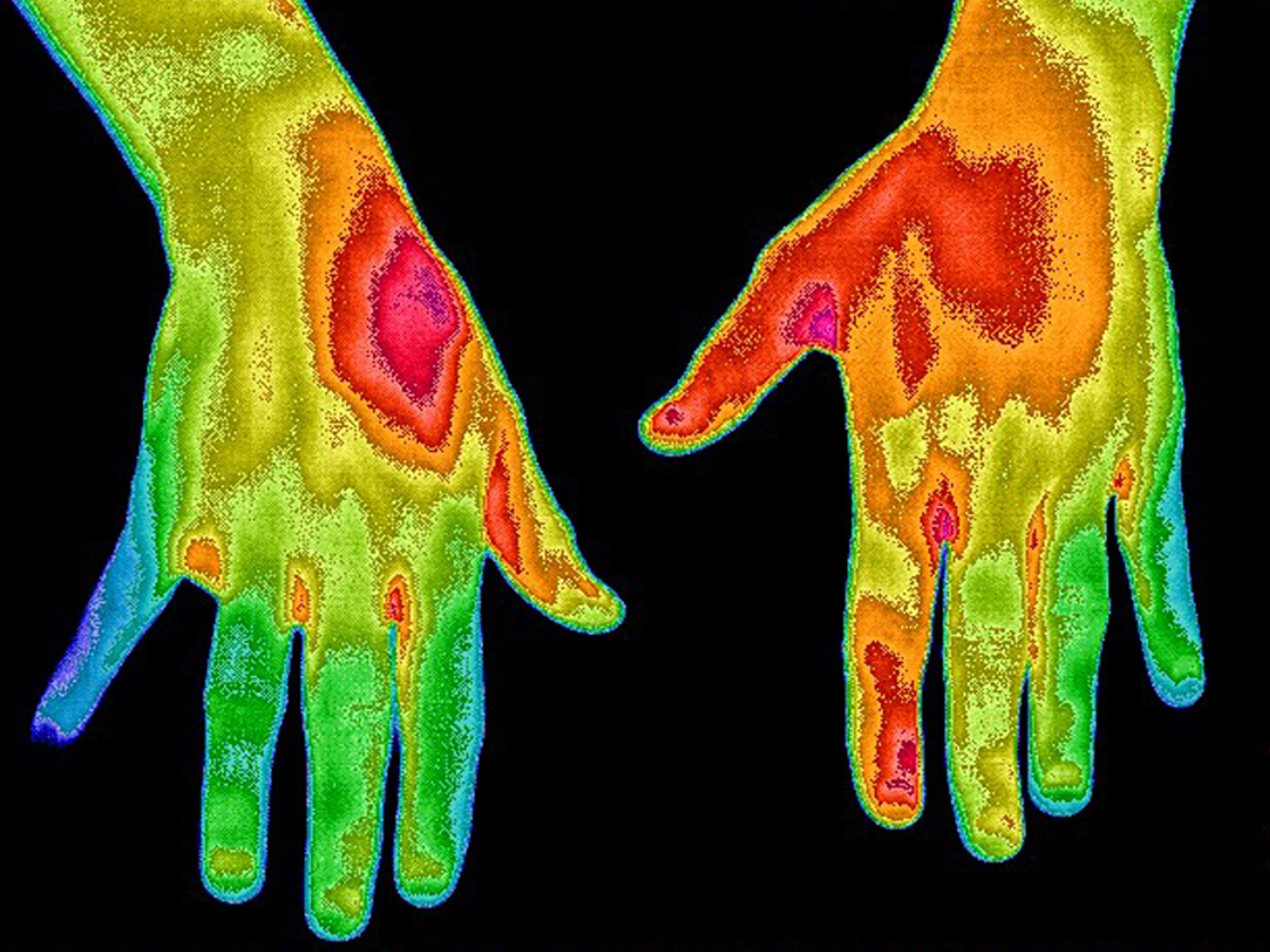 Thermogram of hands one