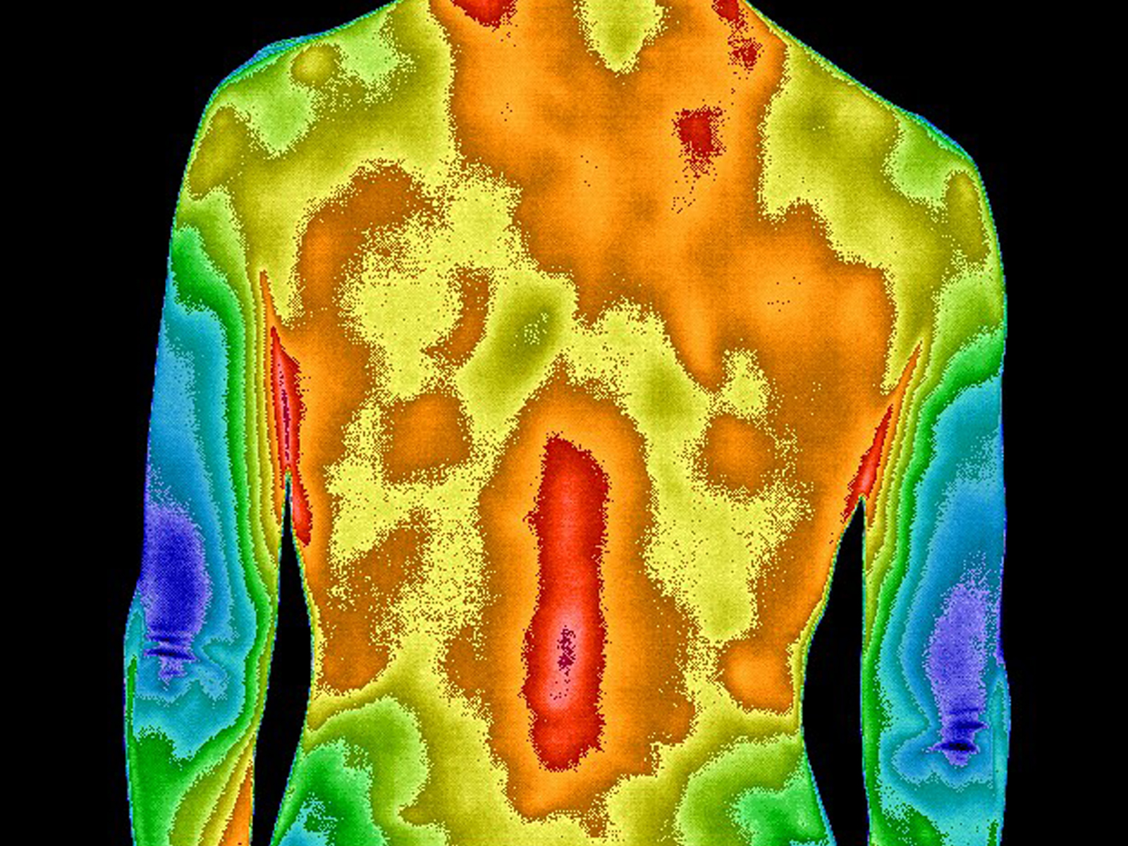 Thermogram of back