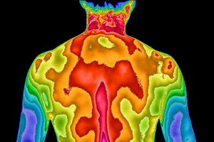 Thermogram of Back