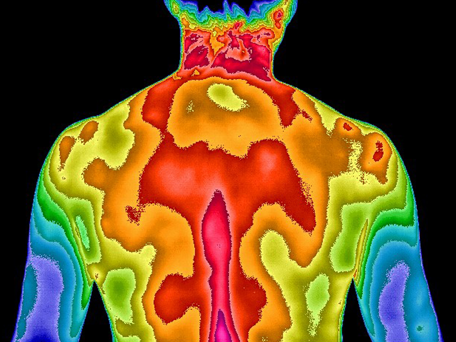 Thermogram of back